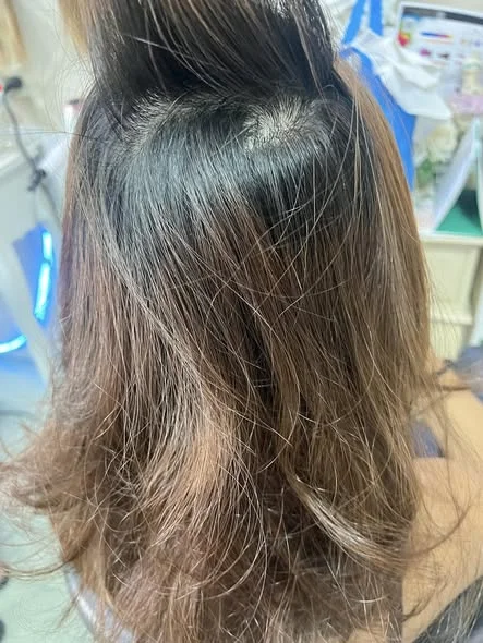 After