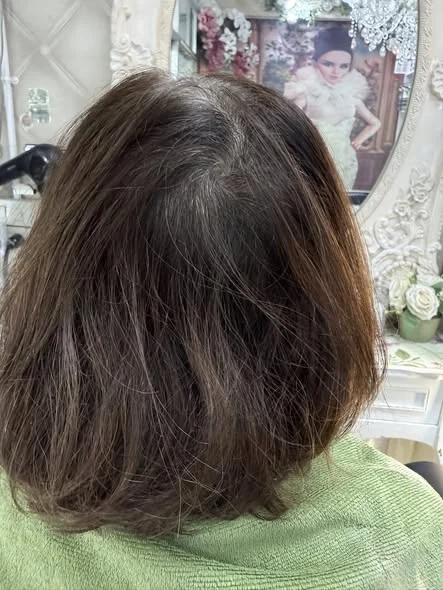 Before