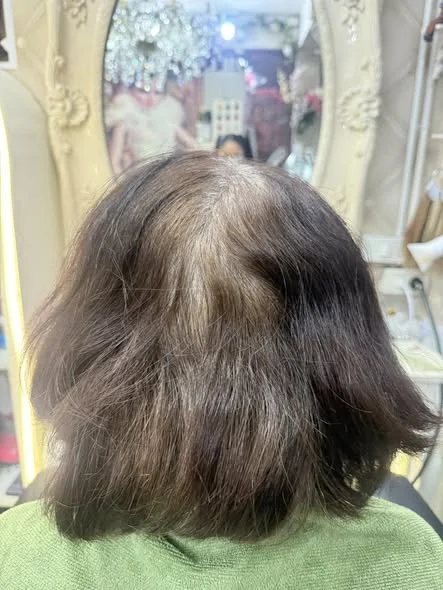 Before
